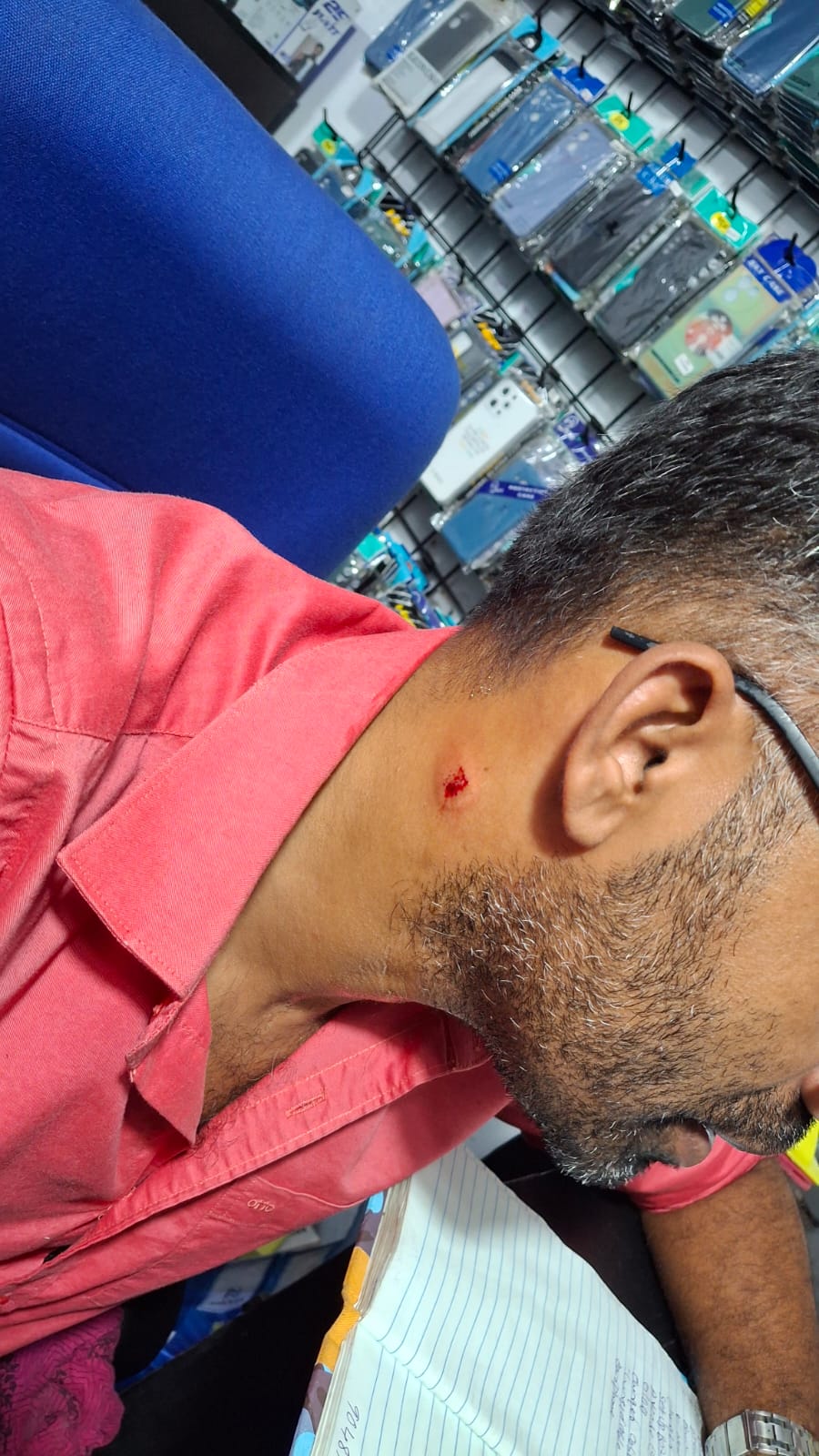 കടങ്ങോട് മില്ല് സെന്ററിൽ കോൺഗ്രസ് പ്രവർത്തകർ നടത്തിയ ആഹ്ലാദ പ്രകടനത്തിനിടയിൽ പടക്കം പൊട്ടിച്ചതിനെ തുടർന്ന് വ്യാപാരിക്ക് പരിക്കേറ്റതായി പരാതി