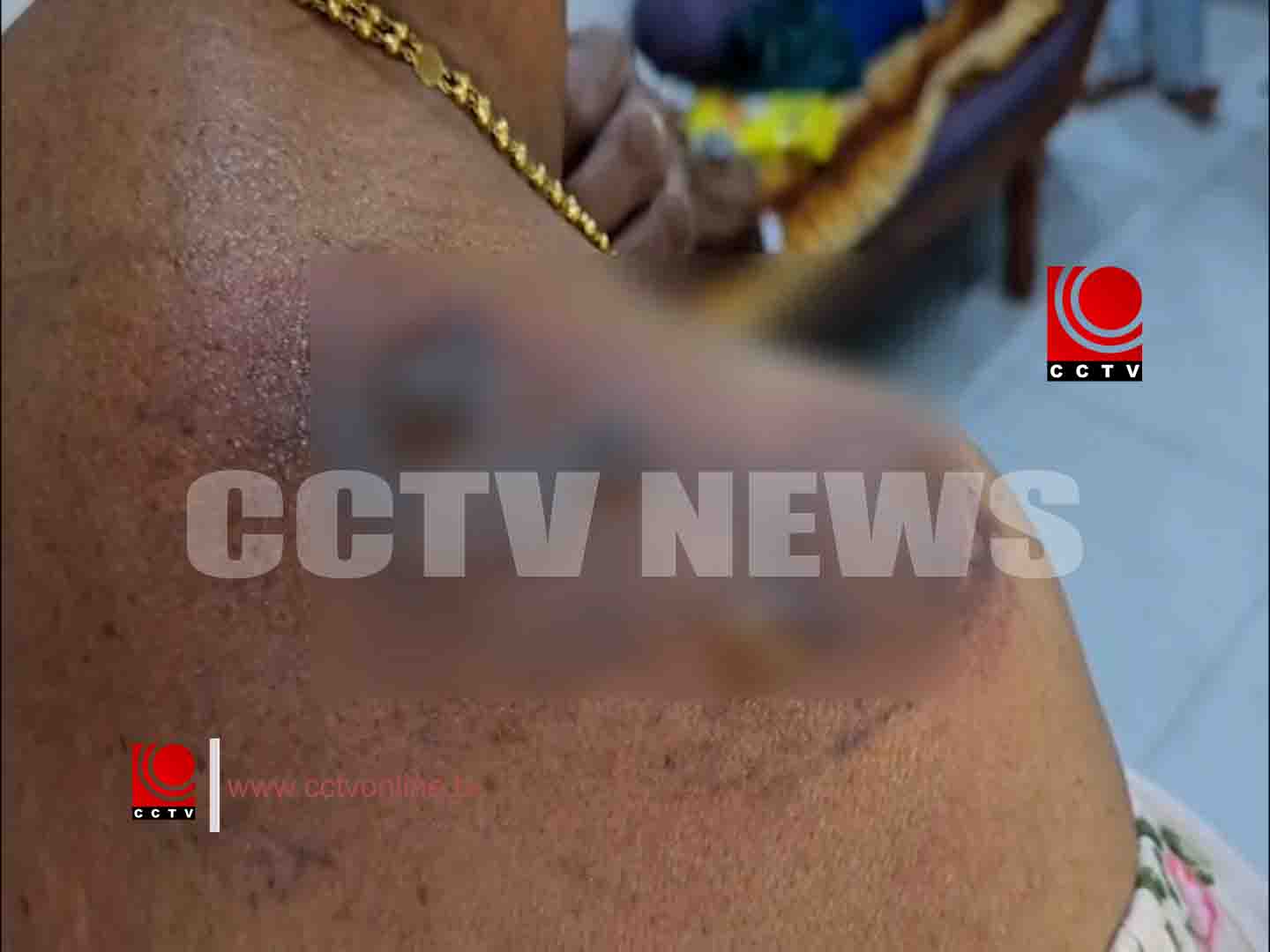 ഗ്യാസ് പൈപ്പ്ലൈന് പൊട്ടിത്തെറിച്ച് ഗൃഹനാഥയ്ക്ക് പൊള്ളലേറ്റ സംഭവത്തില് പ്രതിഷേധം